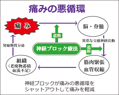 痛みの悪循環